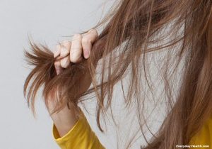 But I'm a Woman! What Is Causing My Hair Loss?