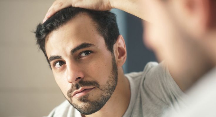 Can Hair Loss in Men Be Stopped?