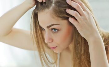Female Hair Loss and Pattern Baldness (Alopecia) In Women