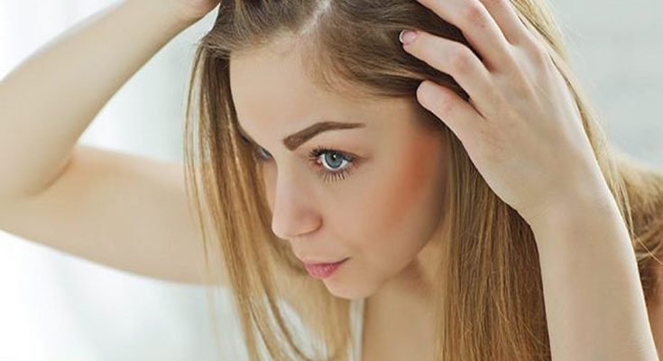 Female Hair Loss and Pattern Baldness (Alopecia) In Women