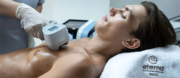 Exilis Ultra 360: The Future of Body Contouring and Skin Tightening